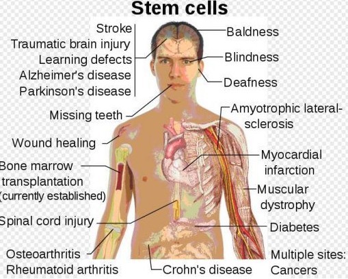 Anatomy and physiology and disease term paper